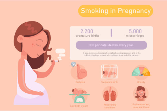 Smoking and Pregnancy: A Clear Visual Guide